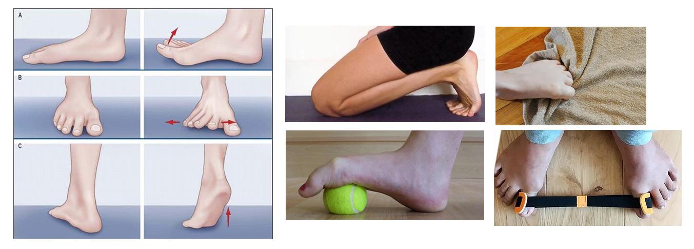 exercises for bunion