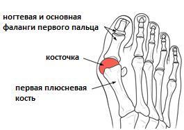 Болит палец на ноге после операции это