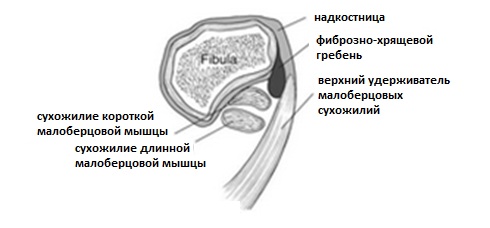 Ушиб длинной малоберцовой мышцы